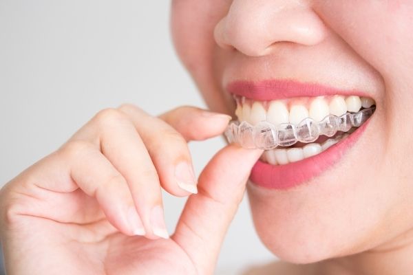 Invisalign orthodontie - Clinique dentaire Ville-Marie