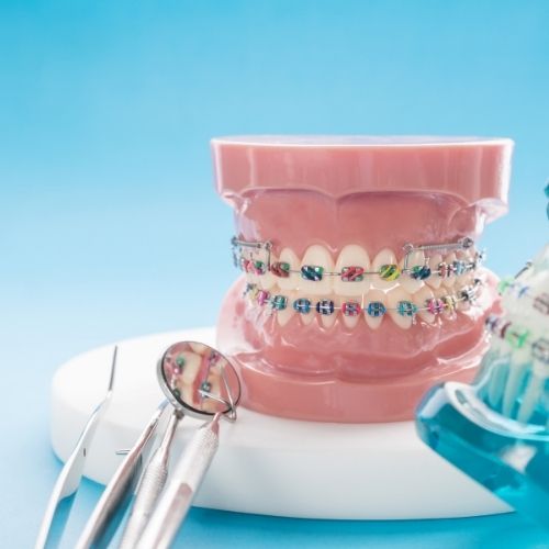 Orthodontie Clinique dentaire Ville-Marie (1)