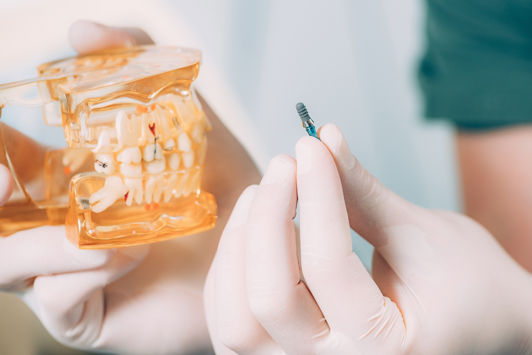 Implant dentaire slider | Centre dentaire Singer à St-Jean-sur-Richelieu